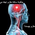 ۳ ساعت اول سکته مغزی، زمان طلایی درمان/ آیا سکته مغزی قابل درمان ست؟